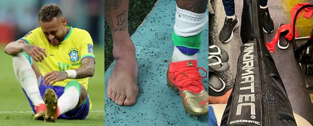 Neymar sufrió una lesión en su tobillo derecho en el primer partido frente a Serbia.