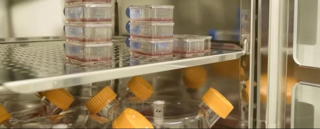 Glóbulos rojos fabricados en laboratorio listos para ser transfundidos a pacientes. Créditos. NHSBT
