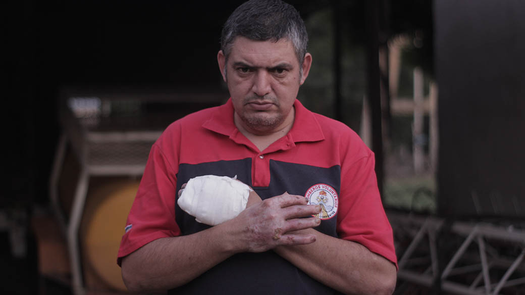 El bombero voluntario de Caá Catí, Corrientes, Omar López muestra las cicatrices del combate contra el fuego