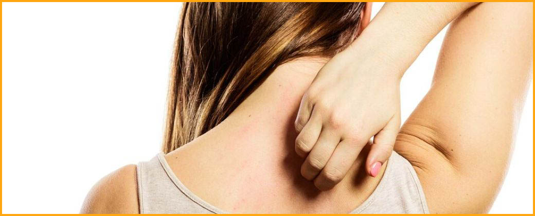 La ciencia encontró el botón de “basta de rascar”. Créditos: iStock.