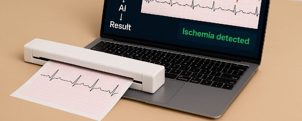 El escáner digitaliza el electrocardiograma y la IA da los resultados en segundos. Créditos: UNSAM.