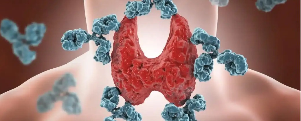 La glándula tiroides se ubica en la base del cuello y tiene forma de mariposa (imagen: adntro.com)